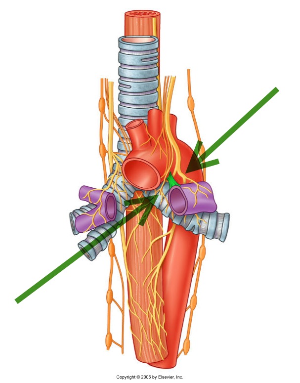 View Ligamentum Arteriosum Pics