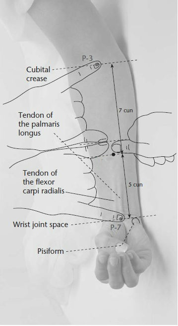 Level 5 - Acupuncture points (upper extremities), - Memrise