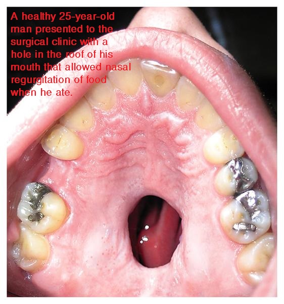 Level 19 - NEJM: Image Challenge, - Memrise Level 19 - NEJM: Image Challenge, - Memrise