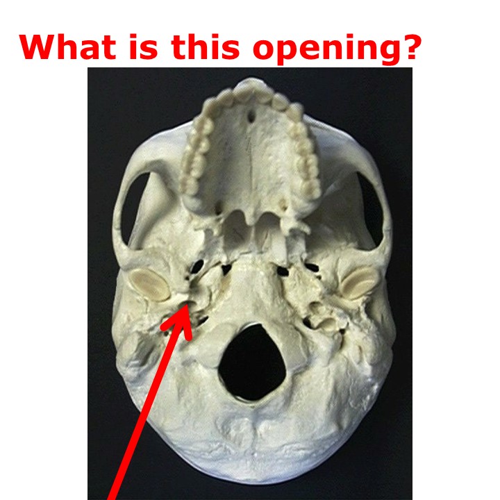 Level 17 - Human Anatomy I, anatomy - Memrise