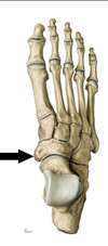 Level 4 - Nilkan,- jalkapöydän,- ja varpaiden luut - Anatomia kuvina ...