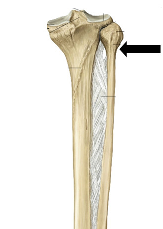 Level 3 - Pohjeluu ja sääriluu - Anatomia kuvina - Memrise