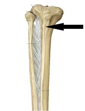 Level 3 - Pohjeluu ja sääriluu - Anatomia kuvina - Memrise