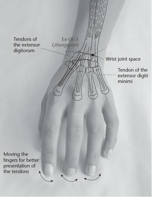 Level 9 - Points on the palm and the wrist - Acupuncture points (uppe ...