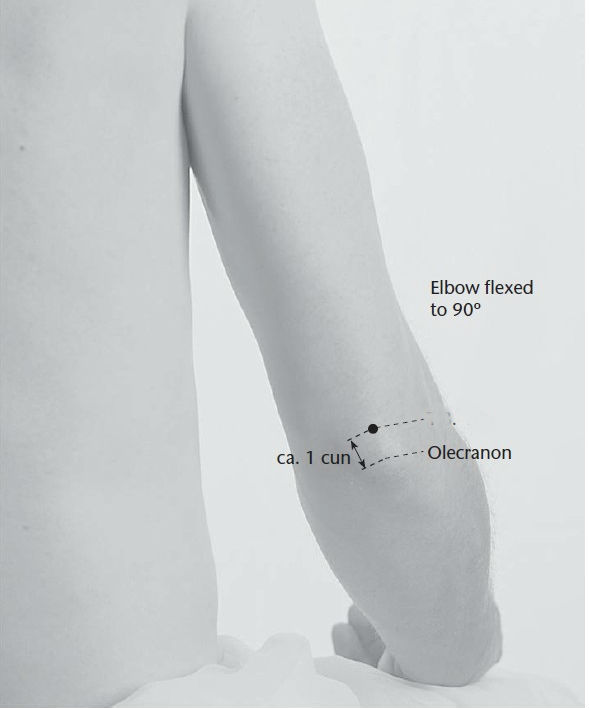 Level 13 - Acupuncture Points (upper Extremities), - Memrise