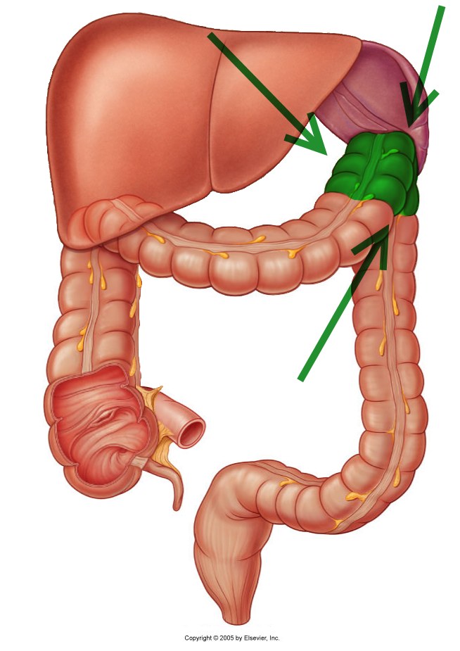 Hepatic Flexure Syndrome
