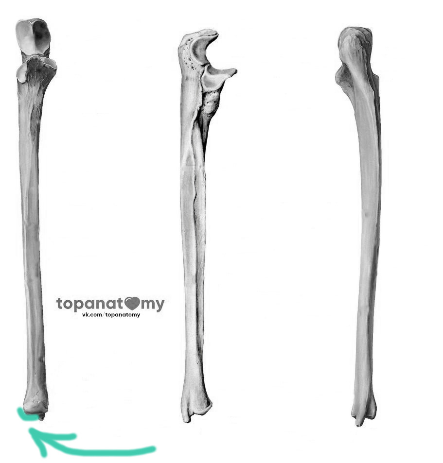 Локтевая кость картинка