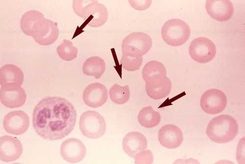 level-4-rode-bloedbeeld-plaatje-haematology-memrise