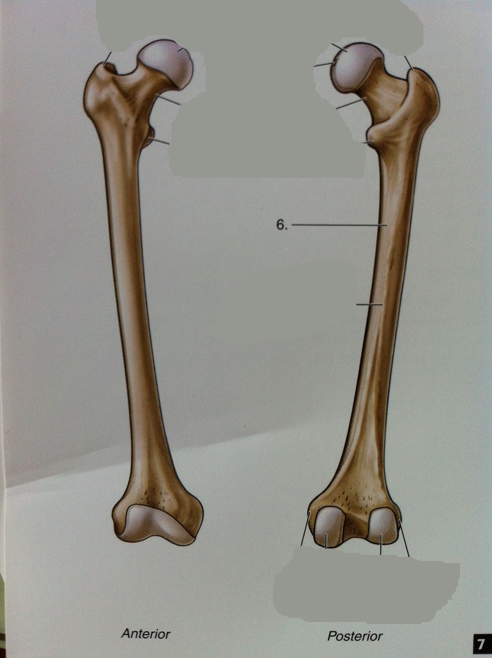 Level 90 7.3 Femur Anatomy of the Extremities Memrise