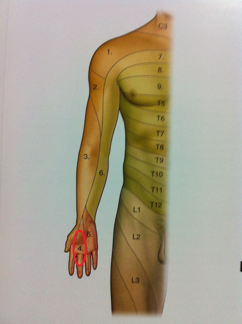 Dermatomes Of The Upper Extremity