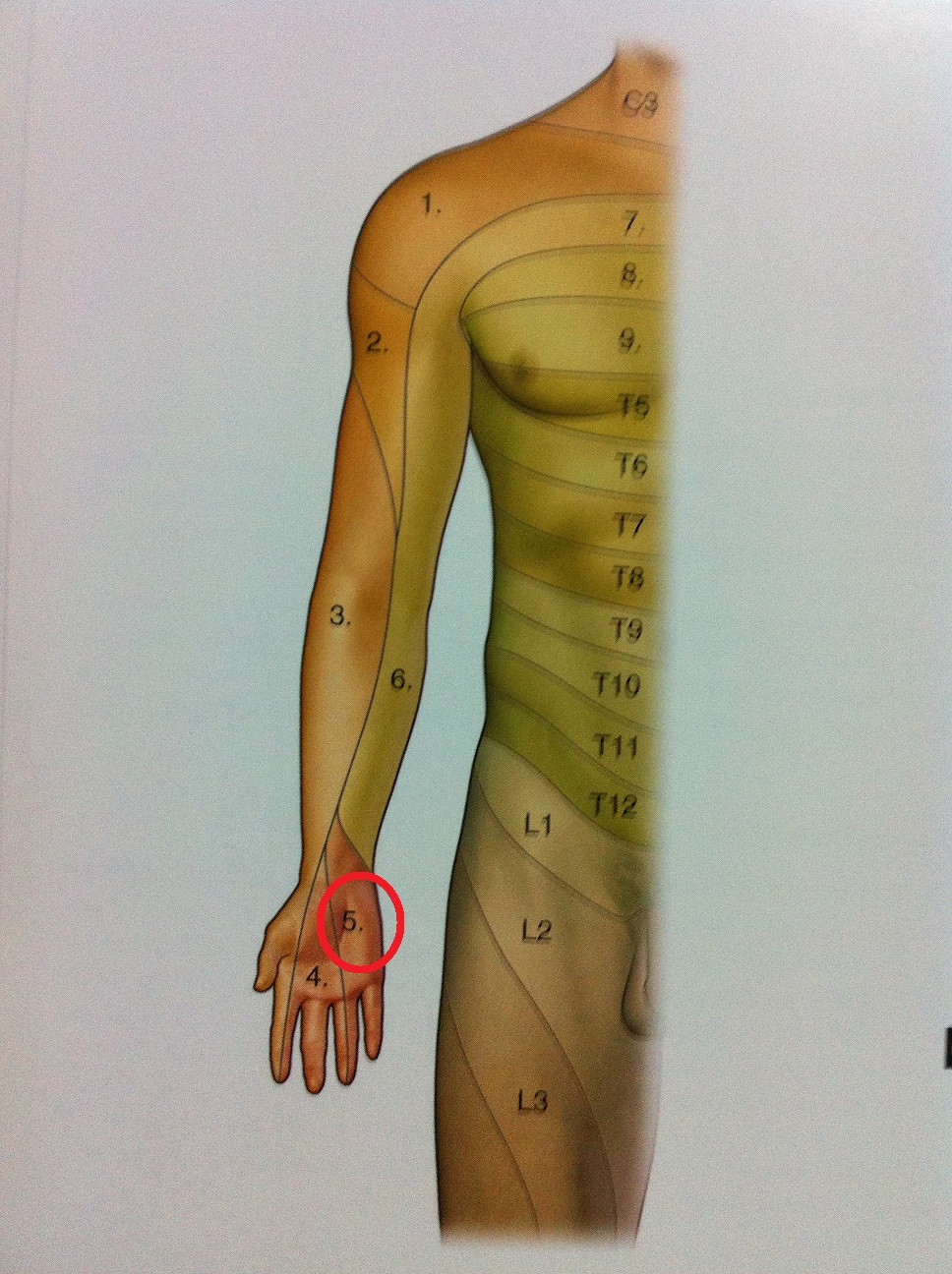 Level 40 6 9 Dermatomes Of Upper Limb Anatomy Of The Extremities