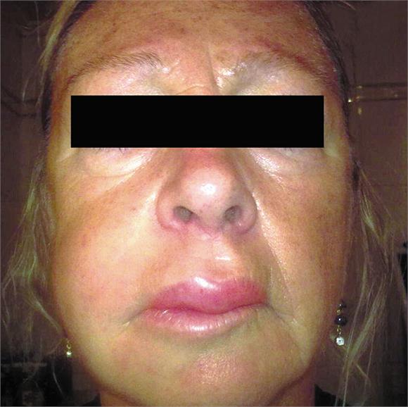 Level 4 - NEJM: Image Challenge - Memrise