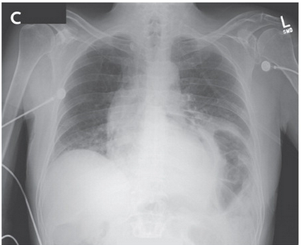 Level 7 - NEJM: Image Challenge - Memrise