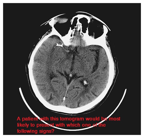 Level 17 - NEJM: Image Challenge - Memrise