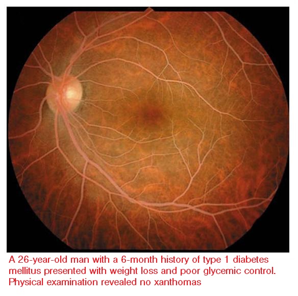 Level 19 - NEJM: Image Challenge - Memrise