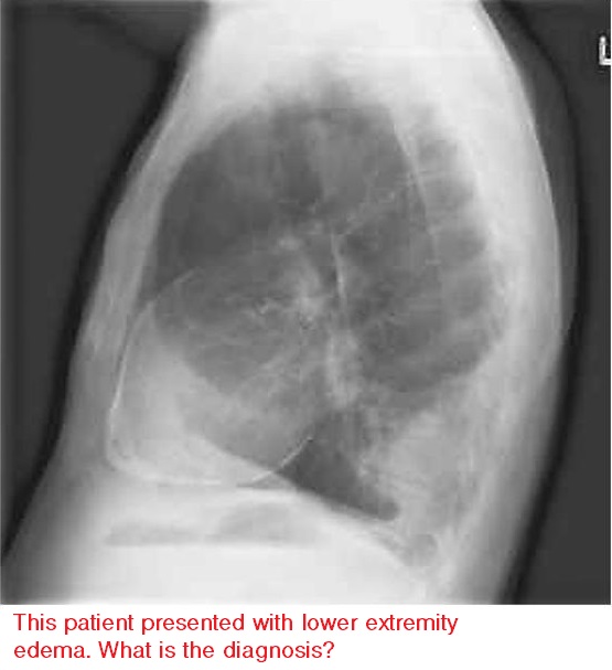 Level 21 - NEJM: Image Challenge - Memrise