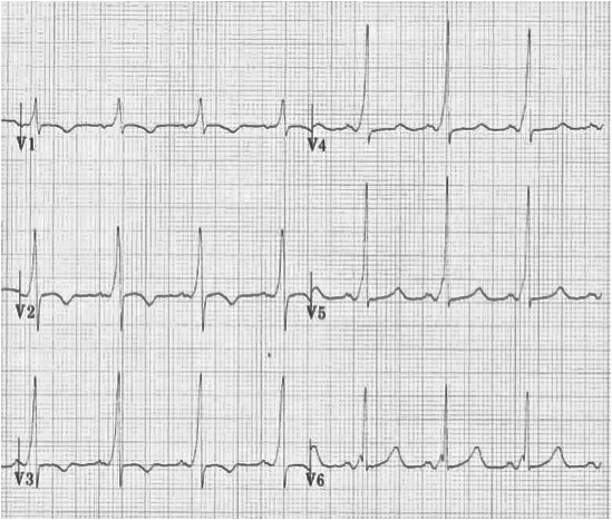 Level 3 - 16 - 30 - EKG - Memrise