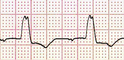 Level 7 EKG Memrise   20862567 131028 2047 18 