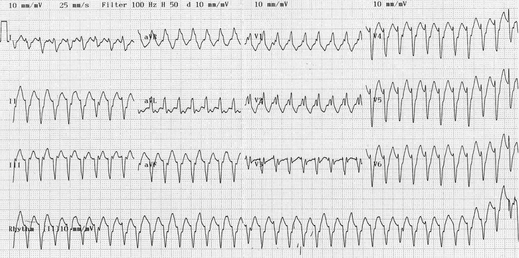 Criteria Of Vt Criteria Of Vt