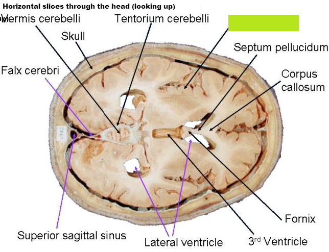 Level 7 - Neuroanatomy (CNS Morphology) - The Nervous System (Oxford ...