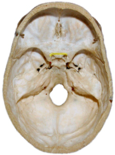 Level 7 - Neuroanatomy (CNS Morphology) - The Nervous System (Oxford ...