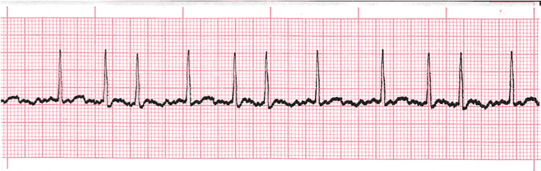 Level 1 - 1 - 10 - ECG - Memrise