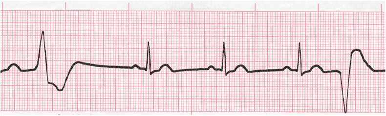 Level 2 - ECG, - Memrise