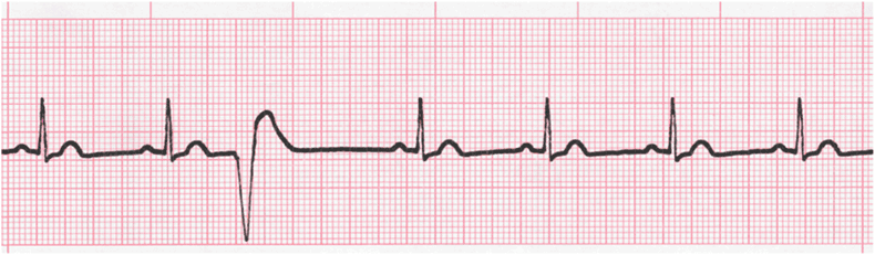 Level 3 - Ecg - Memrise