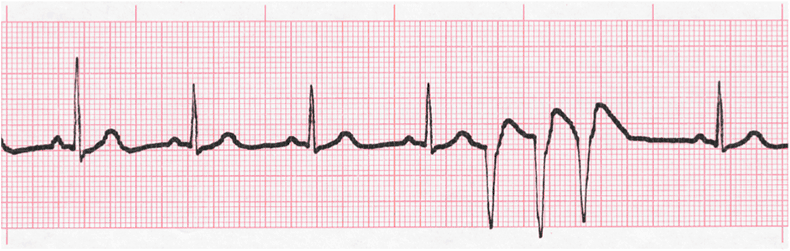 Level 3 - ECG - Memrise