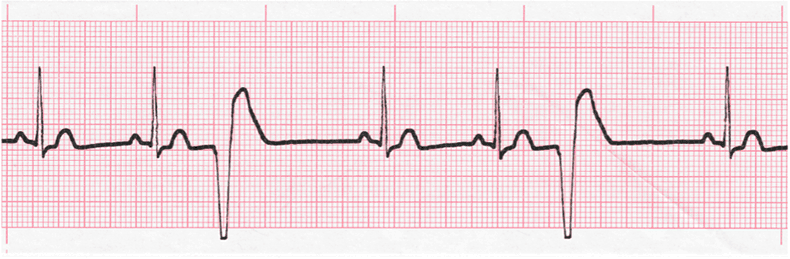 Level 3 - ECG - Memrise