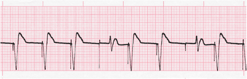 Level 4 - 31 - 33 - Ecg - Memrise