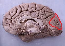 Level 2 - Sulci and Gyri - Human Neuroanatomy - Memrise