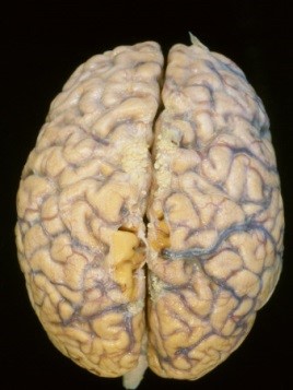Level 1 - Psychology 253 Brain & Be… - Memrise