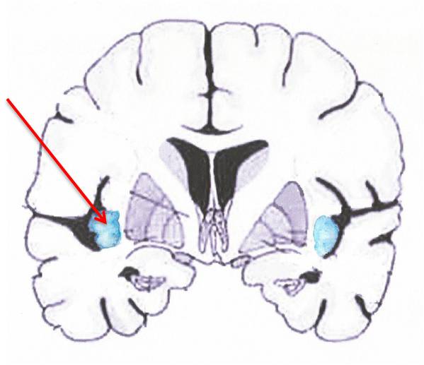 Level 2 - The Basal Ganglia - PS3822 Cognitive Neuroscience - Memrise