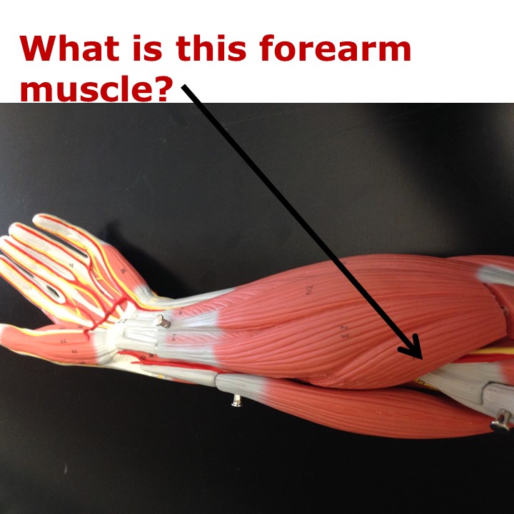 Level 31 - Muscles of the Extremities Models - Human Anatomy I - Memrise