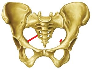 ischial spine